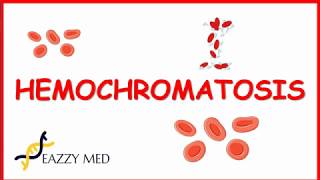 Hemochromatosis causespathophysiologysigns and symptomsdiagnosis and treatment [upl. by Ahsinelg]