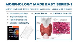 Morphology Series part 1Hashimoto thyroiditisGraves Diseasethyroiditis gravesdiseasemorpholgy [upl. by Deirdra788]