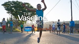 See How The Vaseline Healing Project Helps Heal Skin in South Africa [upl. by Aneela]