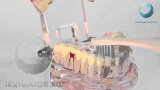 CURAPROX Hydrosonic Dental Care Set CHS 100  звуковая зубная щетка с набором [upl. by Eidoc]