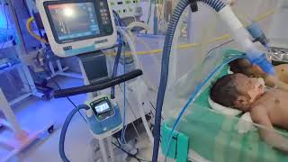 Newborn baby on ventilator in NICU  Neonatal ICU  SNCU  Special Newborn Care Unit [upl. by Leon88]