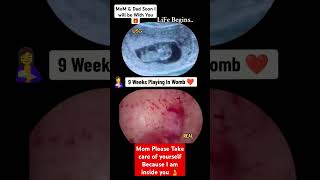 9 Weeks Baby Growing Inside Womb Pregnancy Ultrasound baby pregnancy babyboy babygirl boy [upl. by Noelopan138]