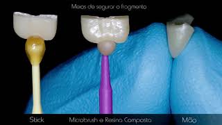 Colagem de Fragmento Dental  Passo a Passo [upl. by Doralyn]