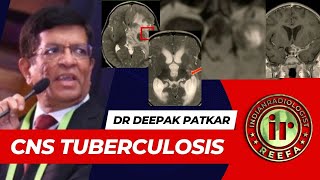 CNS TUBERCULOSIS  DR DEEPAK PATKAR  TB meningitis  Tuberculoma  Cysticercosis  T2Hypo [upl. by Ariek]