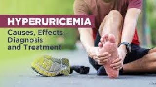 hyperuricemia and its Treatment Gout hyperuricaemia treatment drbadarkhan kneeepain jonpain [upl. by Erny]