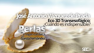 Eco 3D Transesofágico ¿Cuándo es indispensable [upl. by Waldron796]