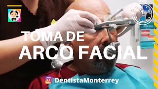 ⏭️ Toma de ARCO FACIAL👅QuickVideo WhipMix ArticuladorDental [upl. by Naesyar]