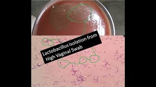 Lactobacillus isolation and its importance in our body [upl. by Inglis]