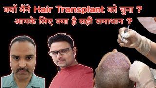 Why i consider hair transplant for Hair loss Real reason Should you also need Hair Transplant [upl. by Oiramrej105]