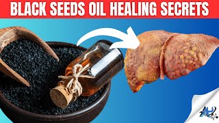 14 Black Seed Oil Benefits Youll Be Surprised To Know [upl. by Airtemad89]