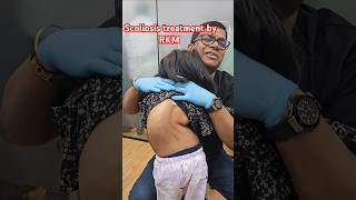 Scoliosis treatment by RKM drrajneeshkant [upl. by Nwahsan]