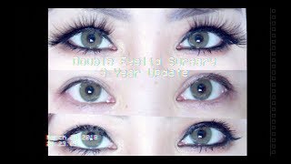 Double Eyelid 3 Year Update [upl. by Esmaria]