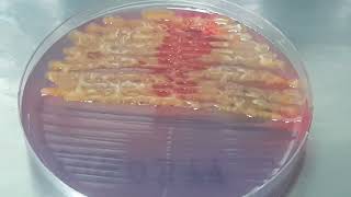 Serratia fonticola on CLED Agar Uropathogen [upl. by Nedac499]