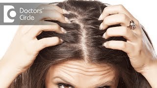 Side effects of Dandruff  Dr Aruna Prasad [upl. by Roper]