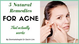 How to treat acne naturally  dermatologist explains [upl. by Wichman]