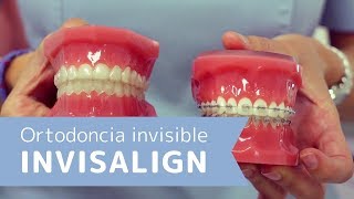 ¿Cómo funciona la ortodoncia invisible o Invisalign Resolvemos tus dudas de este tratamiento dental [upl. by Anikehs283]