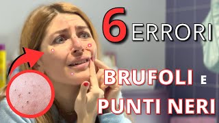 ELIMINARE BRUFOLI E PUNTI NERI 😱5 ERRORI CHE TUTTI FACCIAMO  E COME EVITARLI [upl. by Aneema]