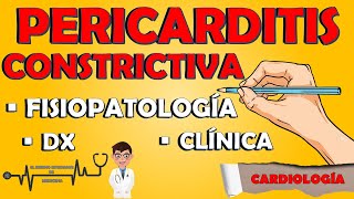 PERICARDITIS CONSTRICTIVA FISIOPATOLOGÍA CAUSAS SÍNTOMAS ECG ECOCARDIOGRAMATRATAMIENTOResumen [upl. by Theron494]