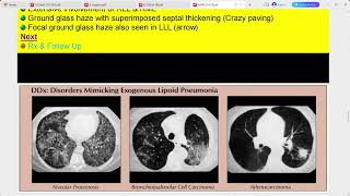 RADIOLOGY EXAM CASES [upl. by Oivalf]