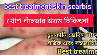 Best treatment for Skin Scabies infectionত্বকের চুলকানি স্কেবিস পাঁচড়া দূর করার সঠিক চিকিৎসা। [upl. by Esoj963]