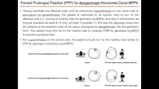 Forced Prolonged Position FPP for Right Apogeotropic Horizontal Canal BPPV [upl. by Ellwood]