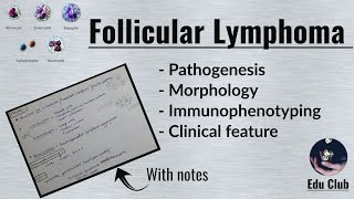 Follicular lymphoma  Non Hodgkins Lymphoma  Pathology [upl. by Llevrac]