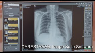 Image Suite Software Streamlines Workflow in Smaller Imaging Facilities [upl. by Reahard]