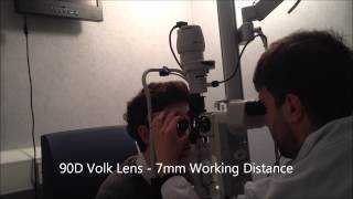 Indirect Ophthalmoscopy with Volk Lens [upl. by Leach]