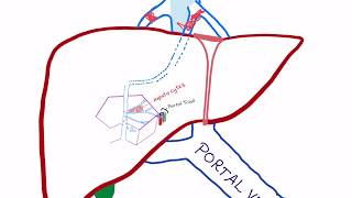 BuddChiari syndrome Pathophysiology [upl. by Dusza]