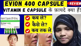 vitamin e capsules evion 400 capsules for face pigmentation pimples ko kese thik karta hai [upl. by Richart]