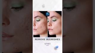 Remove Skin Blemishes in Photohop Tutorial shorts photohsop [upl. by Ecnatsnoc920]