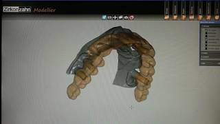 Zirkonzahn system implant type screw retained full arch Prettau [upl. by Strade801]