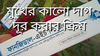 ত্বকে Fungidal HC cream এর কাজ কি  ব্রণ সহ ত্বকের যে কোন সমস্যায় ক্রিম টি ব্যবহার করার নিয়ম [upl. by Michal]