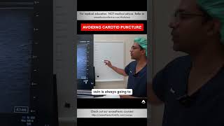 Avoiding Carotid Puncture  shorts cvc anesthesiology nurse [upl. by Petronella866]