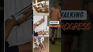 Walking Progress  Tibia Lengthening Patient heightlengthening heightincrease [upl. by Illak]