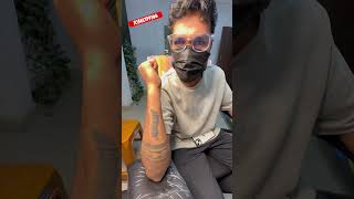 Sangareddy tattoo removal laser one time process [upl. by Tamarra741]