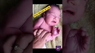 First Minute and First Cry of Beautiful Newborn Baby AfterBirth [upl. by Firehs]