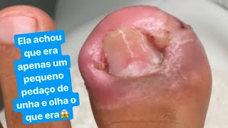 ELA ACHOU QUE ERA UM PEQUENO PEDAÇO De Unha Mas Quando Tirei Olha a Surpresa 😱 Kelly Freitas [upl. by Blanca]