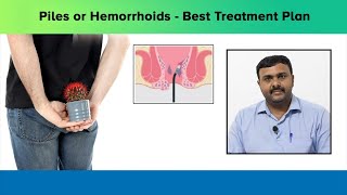 Best treatment for piles or hemorrhoids  Dr Anantha Krishna  Nano hospitals bengaluru [upl. by Annasoh332]