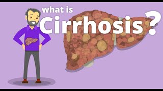 Cirrhosis  What is cirrhosis [upl. by Kerk]