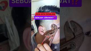 Ada apa didalam sebuah jerawat⁉️faktamenarik mikroskop [upl. by Eeramit292]