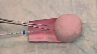 Hormonal IUD LNGIUS Insertion Technique [upl. by Joice]