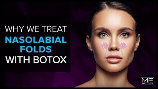 Using BOTOX® To Treat Nasolabial Folds at Mabrie Facial Institute [upl. by Zitvaa193]