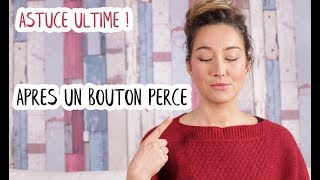 2 produits INCONTOURNABLES pour faire CICATRISER son BOUTON après l’avoir percé [upl. by Brunk868]