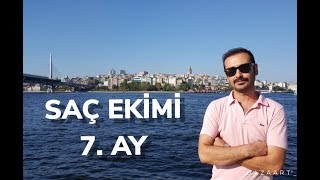 SAÇ EKİMİ 7 AY [upl. by Leksehc]