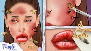 ASMR Satisfying Bee Sting Treatment For Ariana Animation  Severely Injured Animation [upl. by Zaria]