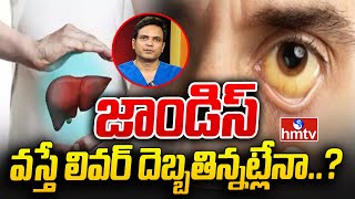 Jaundice జాండిస్ వస్తే లివర్ దెబ్బతిన్నట్లేనా  hmtv healthplus [upl. by Dnalon]