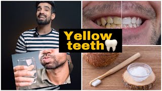 Yellow Teeth Cure Natural🦷🥥 shorts yellowteeth [upl. by Kym]