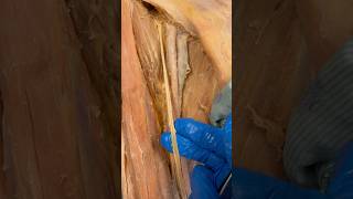 Real Femoral Artery amp Nerve [upl. by Sioled]