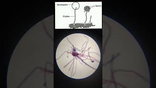 Rhizopus slide under MicroscopeMicroorganism [upl. by Marley]